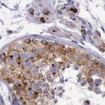 GOLGA5 Antibody in Immunohistochemistry (IHC)