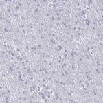 Cystatin A Antibody in Immunohistochemistry (Paraffin) (IHC (P))