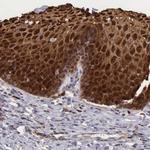 Cystatin A Antibody in Immunohistochemistry (Paraffin) (IHC (P))