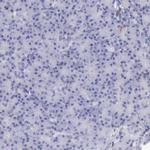 Cystatin A Antibody in Immunohistochemistry (Paraffin) (IHC (P))