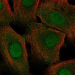 Cystatin A Antibody in Immunocytochemistry (ICC/IF)