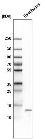 Cystatin A Antibody in Western Blot (WB)