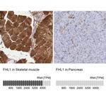 FHL1 Antibody in Immunohistochemistry (IHC)