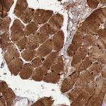 FHL1 Antibody in Immunohistochemistry (IHC)