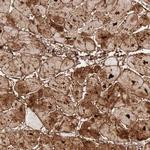 FHL1 Antibody in Immunohistochemistry (IHC)