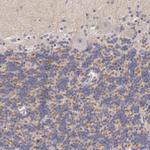 KV4.1 (KCND1) Antibody in Immunohistochemistry (IHC)