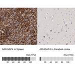 RhoGAP4 Antibody in Immunohistochemistry (IHC)