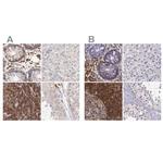 RhoGAP4 Antibody in Immunohistochemistry (IHC)