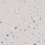 RhoGAP4 Antibody in Immunohistochemistry (IHC)