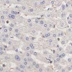 RhoGAP4 Antibody in Immunohistochemistry (IHC)