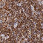 RhoGAP4 Antibody in Immunohistochemistry (IHC)