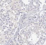 SASH3 Antibody in Immunohistochemistry (Paraffin) (IHC (P))