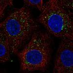 PTGR2 Antibody in Immunocytochemistry (ICC/IF)