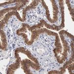 PTGR2 Antibody in Immunohistochemistry (Paraffin) (IHC (P))