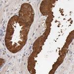 PTGR2 Antibody in Immunohistochemistry (Paraffin) (IHC (P))