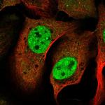 SNRPD3 Antibody in Immunocytochemistry (ICC/IF)