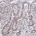 SNRPD3 Antibody in Immunohistochemistry (IHC)