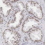 SNRPD3 Antibody in Immunohistochemistry (IHC)