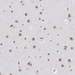 SNRPD3 Antibody in Immunohistochemistry (IHC)