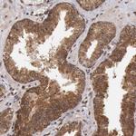 STX17 Antibody in Immunohistochemistry (IHC)