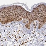 STX17 Antibody in Immunohistochemistry (IHC)