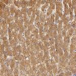 CBS Antibody in Immunohistochemistry (IHC)