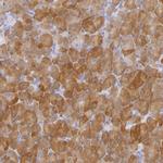 CBS Antibody in Immunohistochemistry (IHC)