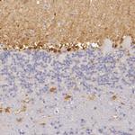 CBS Antibody in Immunohistochemistry (IHC)