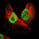 SMEK2 Antibody in Immunocytochemistry (ICC/IF)