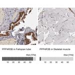 SMEK2 Antibody in Immunohistochemistry (IHC)