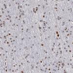 SMEK2 Antibody in Immunohistochemistry (IHC)