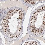 SMEK2 Antibody in Immunohistochemistry (IHC)