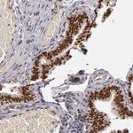 SMEK2 Antibody in Immunohistochemistry (IHC)