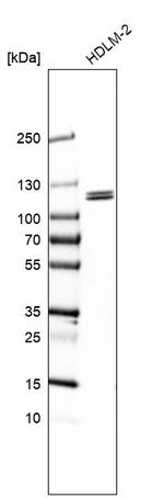 SMEK2 Antibody in Western Blot (WB)