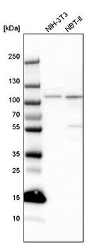 SMEK2 Antibody in Western Blot (WB)