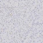 PLOD3 Antibody in Immunohistochemistry (Paraffin) (IHC (P))