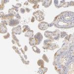 PLOD3 Antibody in Immunohistochemistry (Paraffin) (IHC (P))