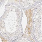 PLOD3 Antibody in Immunohistochemistry (Paraffin) (IHC (P))