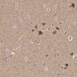 Cytochrome C1 Antibody in Immunohistochemistry (Paraffin) (IHC (P))