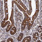 Cytochrome C1 Antibody in Immunohistochemistry (Paraffin) (IHC (P))