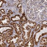 Cytochrome C1 Antibody in Immunohistochemistry (Paraffin) (IHC (P))