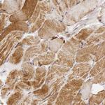 Cytochrome C1 Antibody in Immunohistochemistry (Paraffin) (IHC (P))