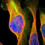 NMT2 Antibody in Immunocytochemistry (ICC/IF)