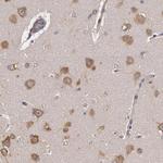 NMT2 Antibody in Immunohistochemistry (Paraffin) (IHC (P))