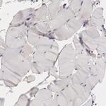 NMT2 Antibody in Immunohistochemistry (Paraffin) (IHC (P))