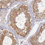 NMT2 Antibody in Immunohistochemistry (Paraffin) (IHC (P))