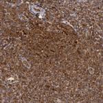 TAP2 Antibody in Immunohistochemistry (Paraffin) (IHC (P))