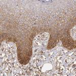 Syntaxin 4 Antibody in Immunohistochemistry (IHC)