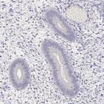 MYH6 Antibody in Immunohistochemistry (Paraffin) (IHC (P))