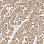 MYH6 Antibody in Immunohistochemistry (Paraffin) (IHC (P))